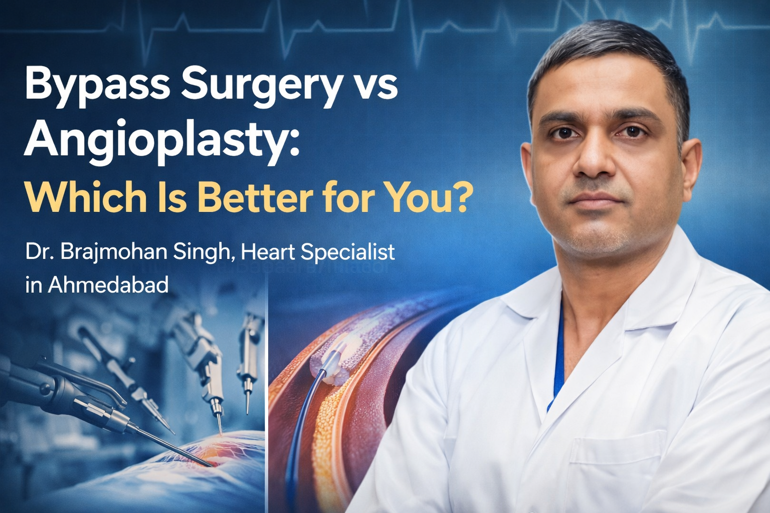 Bypass Surgery vs Angioplasty