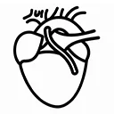 BIMA Bypass Surgery
